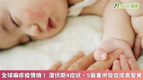 a流可以上班嗎|A型流感怎麼辦？一文秒懂症狀、併發症、潛伏期、傳染期4大重點